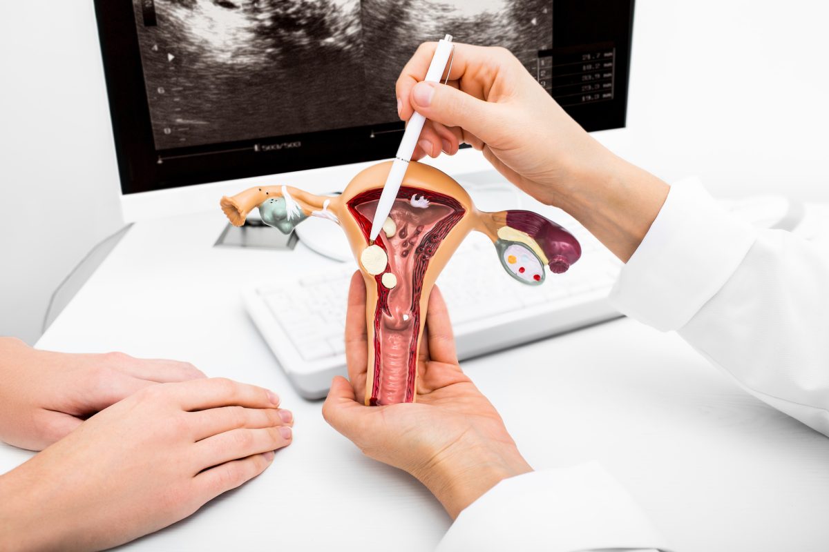 Hysterectomy (removal of the uterus)